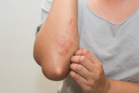 stop spread of infection